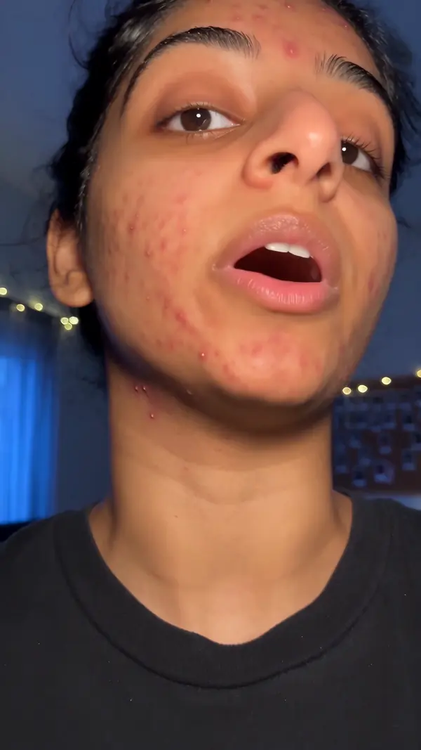 Skinfolk - Rooftop testimonial, unfiltered skin